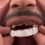 smile5